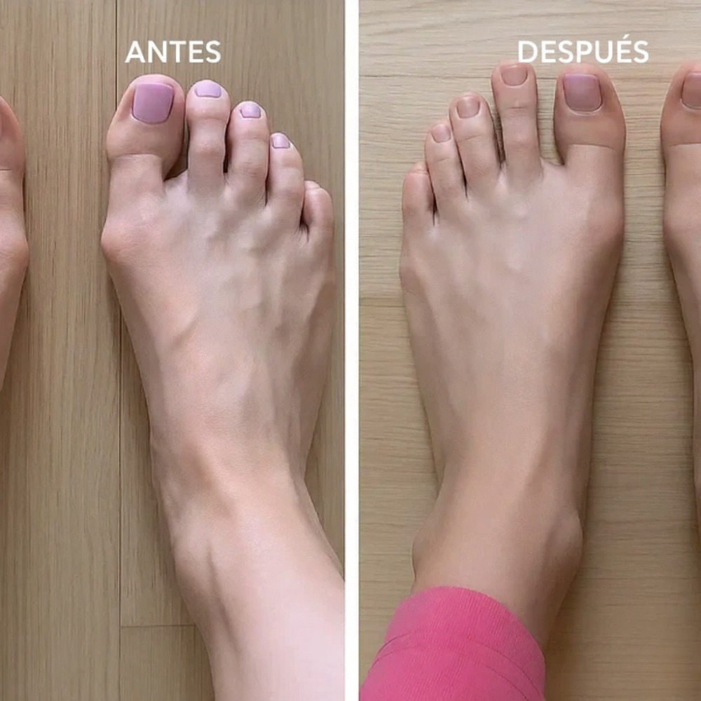 María™ | Férula Suave de Apoyo para Juanetes